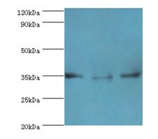 AIMP2 Antibody - Western blot. All lanesAIMP2 antibody at 5 ug/ml. Lane 1: HeLa whole cell lysate. Lane 2: HepG2 whole cell lysate. Lane 3: K562 whole cell lysate. Secondary antibody: Goat polyclonal to rabbit at 1:10000 dilution. Predicted band size: 35 kDa. Observed band size: 35 kDa.