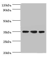 AIMP2 Antibody - Western blot All lanes: AIMP2 antibody at 5µg/ml Lane 1: Hela whole cell lysate Lane 2: HepG2 whole cell lysate Lane 3: K562 whole cell lysate Secondary Goat polyclonal to rabbit IgG at 1/10000 dilution Predicted band size: 35 kDa Observed band size: 35 kDa