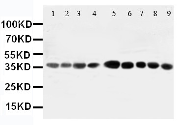 AIMP2 Antibody - WB of AIMP2 antibody. All lanes: Anti-AIMP2 at 0.5ug/ml. Lane 1: Rat Liver Tissue Lysate at 40ug. Lane 2: Rat Lung Tissue Lysate at 40ug. Lane 3: Rat Kidney Tissue Lysate at 40ug. Lane 4: Rat Brain Tissue Lysate at 40ug. Lane 5: JURKAT Whole Cell Lysate at 40ug. Lane 6: CEM Whole Cell Lysate at 40ug. Lane 7: HUT Whole Cell Lysate at 40ug. Lane 8: U93T Whole Cell Lysate at 40ug. Lane 9: U93T Whole Cell Lysate at 40ug. Predicted bind size: 35KD. Observed bind size: 35KD.