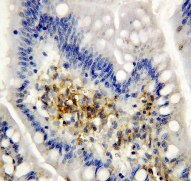 AIMP2 Antibody - IHC analysis of AIMP2 using anti-AIMP2 antibody. AIMP2 was detected in paraffin-embedded section of rat intestine tissues. Heat mediated antigen retrieval was performed in citrate buffer (pH6, epitope retrieval solution) for 20 mins. The tissue section was blocked with 10% goat serum. The tissue section was then incubated with 1µg/ml rabbit anti-AIMP2 Antibody overnight at 4°C. Biotinylated goat anti-rabbit IgG was used as secondary antibody and incubated for 30 minutes at 37°C. The tissue section was developed using Strepavidin-Biotin-Complex (SABC) with DAB as the chromogen.