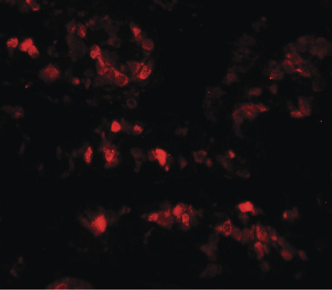 AIMP2 Antibody - Immunofluorescence of AIMP2 in rat small intestine tissue with AIMP2 antibody at 20 ug/ml.