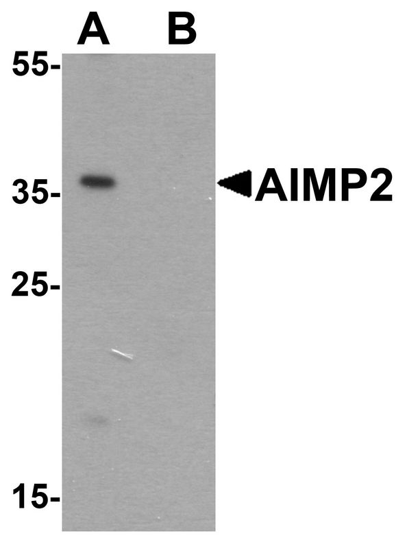 AIMP2 Antibody - Western blot analysis of AIMP2 in HeLa cell lysate with AIMP2 antibody at 1 ug/ml in (A) the absence and (B) the presence of blocking peptide.