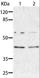 AIMP2 Antibody - Western blot analysis of HepG2 and A549 cell, using AIMP2 Polyclonal Antibody at dilution of 1:350.