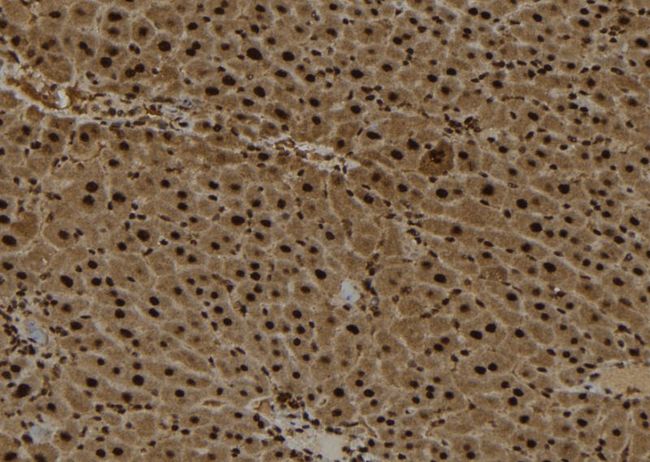 AIMP2 Antibody - 1:100 staining mouse liver tissue by IHC-P. The sample was formaldehyde fixed and a heat mediated antigen retrieval step in citrate buffer was performed. The sample was then blocked and incubated with the antibody for 1.5 hours at 22°C. An HRP conjugated goat anti-rabbit antibody was used as the secondary.