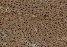 AIMP2 Antibody - 1:100 staining mouse liver tissue by IHC-P. The sample was formaldehyde fixed and a heat mediated antigen retrieval step in citrate buffer was performed. The sample was then blocked and incubated with the antibody for 1.5 hours at 22°C. An HRP conjugated goat anti-rabbit antibody was used as the secondary.