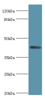 AIPL1 Antibody - Western blot. All lanes: Aryl-hydrocarbon-interacting protein-like 1 antibody at 5 ug/ml+Rat brain tissue. Secondary antibody: Goat polyclonal to rabbit at 1:10000 dilution. Predicted band size: 44 kDa. Observed band size: 44 kDa Immunohistochemistry.