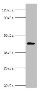 AIPL1 Antibody - Western blot All lanes: Aryl-hydrocarbon-interacting protein-like 1 antibody at 5µg/ml + Rat brain tissue Secondary Goat polyclonal to rabbit IgG at 1/10000 dilution Predicted band size: 44, 37, 42, 41 kDa Observed band size: 44 kDa