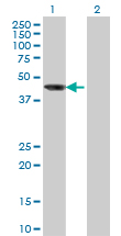 AIPL1 Antibody - Western blot of AIPL1 expression in transfected 293T cell line by AIPL1 monoclonal antibody (M04), clone 1E1.