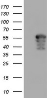 AIPL1 Antibody - HEK293T cells were transfected with the pCMV6-ENTRY control (Left lane) or pCMV6-ENTRY AIPL1 (Right lane) cDNA for 48 hrs and lysed. Equivalent amounts of cell lysates (5 ug per lane) were separated by SDS-PAGE and immunoblotted with anti-AIPL1.