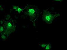AIPL1 Antibody - Anti-AIPL1 mouse monoclonal antibody immunofluorescent staining of COS7 cells transiently transfected by pCMV6-ENTRY AIPL1.
