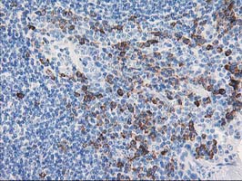 AIPL1 Antibody - IHC of paraffin-embedded Human lymph node tissue using anti-AIPL1 mouse monoclonal antibody.