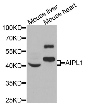 AIPL1 Antibody - Western blot analysis of extracts of various cells.