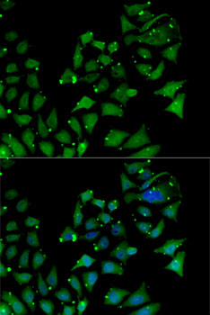 AIPL1 Antibody - Immunofluorescence analysis of MCF7 cells using AIPL1 antibody. Blue: DAPI for nuclear staining.