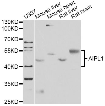 AIPL1 Antibody - Western blot analysis of extracts of various cell lines, using AIPL1 antibody at 1:1000 dilution. The secondary antibody used was an HRP Goat Anti-Rabbit IgG (H+L) at 1:10000 dilution. Lysates were loaded 25ug per lane and 3% nonfat dry milk in TBST was used for blocking. An ECL Kit was used for detection and the exposure time was 90s.