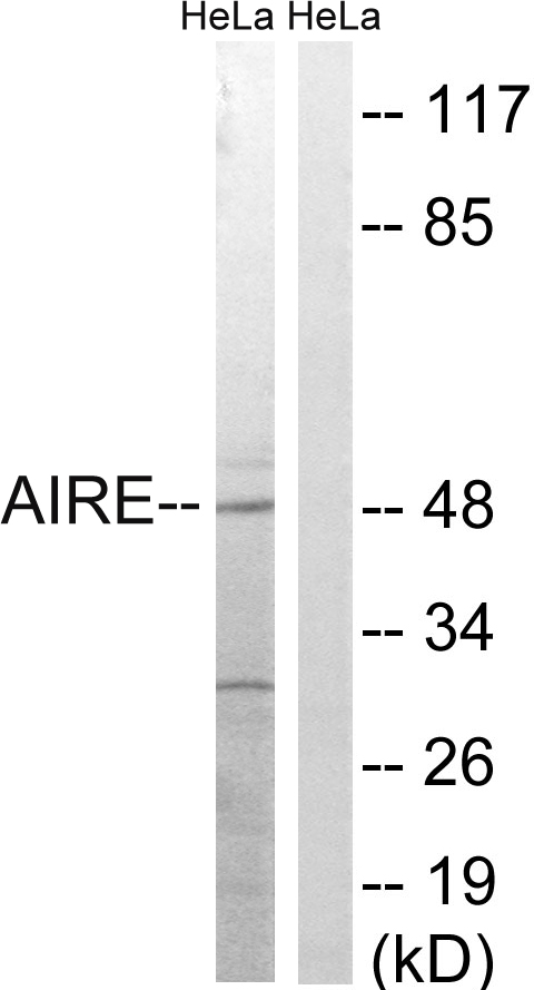 AIRE Antibody - Western blot analysis of lysates from HeLa cells, treated with Hu 2nM 24h, using AIRE Antibody. The lane on the right is blocked with the synthesized peptide.