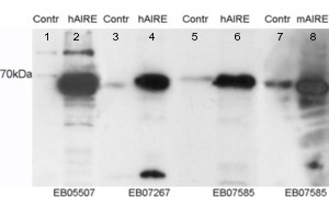 AIRE Antibody - AIRE antibody staining (0.05µg/ml) of HEK293 cell lysates. Untransfected (Lane 5 and 7) and transfected with Human AIRE (lane 6) or Mouse AIRE (lane 7). Data kindly provided by Prof. Pärt Peterson, University of Tartu, Estonia.