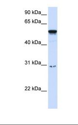 AIRE Antibody - Placenta lysate. Antibody concentration: 1.0 ug/ml. Gel concentration: 12%.  This image was taken for the unconjugated form of this product. Other forms have not been tested.