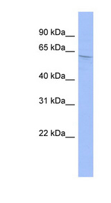 AIRE Antibody - AIRE antibody Western blot of OVCAR-3 cell lysate. This image was taken for the unconjugated form of this product. Other forms have not been tested.