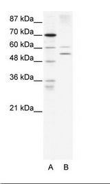 AIRE Antibody - A: Marker, B: HepG2 Cell Lysate.  This image was taken for the unconjugated form of this product. Other forms have not been tested.