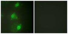 AIRE Antibody - Immunofluorescence analysis of HeLa cells, using AIRE Antibody. The picture on the right is blocked with the synthesized peptide.