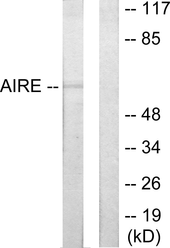 AIRE Antibody - Western blot analysis of lysates from 293 cells, using AIRE Antibody. The lane on the right is blocked with the synthesized peptide.