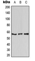 AIRE Antibody - Western blot analysis of AIRE expression in Jurkat (A); mouse lung (B); rat lung (C) whole cell lysates.