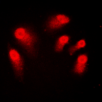AIRE Antibody - Immunofluorescent analysis of AIRE staining in Jurkat cells. Formalin-fixed cells were permeabilized with 0.1% Triton X-100 in TBS for 5-10 minutes and blocked with 3% BSA-PBS for 30 minutes at room temperature. Cells were probed with the primary antibody in 3% BSA-PBS and incubated overnight at 4 C in a humidified chamber. Cells were washed with PBST and incubated with a DyLight 594-conjugated secondary antibody (red) in PBS at room temperature in the dark. DAPI was used to stain the cell nuclei (blue).