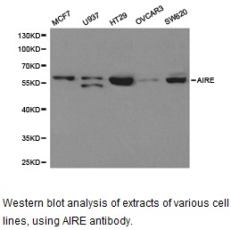 AIRE Antibody - Western blot.