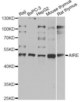 AIRE Antibody - Western blot analysis of extracts of various cell lines, using AIRE antibody at 1:1000 dilution. The secondary antibody used was an HRP Goat Anti-Rabbit IgG (H+L) at 1:10000 dilution. Lysates were loaded 25ug per lane and 3% nonfat dry milk in TBST was used for blocking. An ECL Kit was used for detection and the exposure time was 1s.