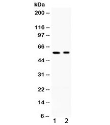 AIRE Antibody - Western blot testing of 1) rat testis and 2) human HeLa lysate with AIRE antibody at 0.5ug/ml. Expected molecular weight ~58 kDa.