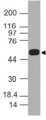 AIRE Antibody - Fig-1: Western blot analysis of AIRE/APECED. Anti-AIRE/APECED antibody was used at 1 µg/ml on h Liver lysate.