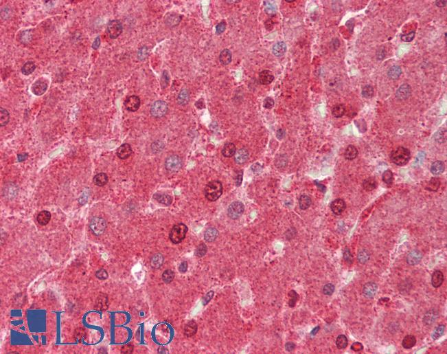 AIRE Antibody - Human Liver: Formalin-Fixed, Paraffin-Embedded (FFPE).  This image was taken for the unconjugated form of this product. Other forms have not been tested.