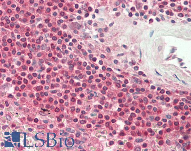 AIRE Antibody - Human Spleen: Formalin-Fixed, Paraffin-Embedded (FFPE).  This image was taken for the unconjugated form of this product. Other forms have not been tested.