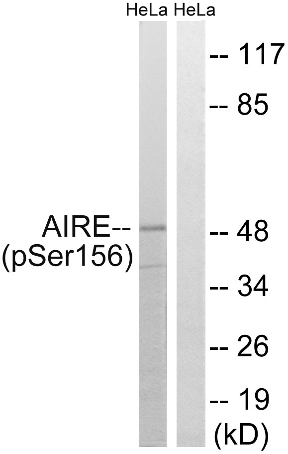 AIRE Antibody - Western blot analysis of lysates from HeLa cells treated with Hu 2nM 24h, using AIRE (Phospho-Ser156) Antibody. The lane on the right is blocked with the phospho peptide.