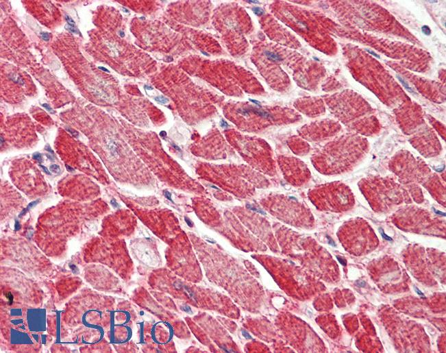 AK1 / Adenylate Kinase 1 Antibody - Anti-AK1 / Adenylate Kinase 1 antibody IHC staining of human heart. Immunohistochemistry of formalin-fixed, paraffin-embedded tissue after heat-induced antigen retrieval. Antibody concentration 5 ug/ml.  This image was taken for the unconjugated form of this product. Other forms have not been tested.