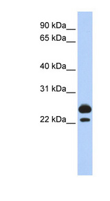 AK1 / Adenylate Kinase 1 Antibody - AK1 / Myokinase antibody Western blot of Fetal Muscle lysate.  This image was taken for the unconjugated form of this product. Other forms have not been tested.