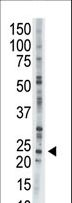 AK1 / Adenylate Kinase 1 Antibody - The anti-AK1 antibody is used in Western blot to detect AK1 in CHO cell lysate.