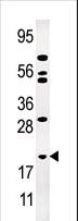 AK1 / Adenylate Kinase 1 Antibody - Western blot of anti-AK1 antibody in Jurkat cell line lysate (35 ug/lane). AK1(arrow) was detected using the purified antibody.