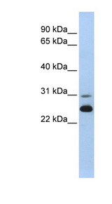 AK1 / Adenylate Kinase 1 Antibody - AK1 / Myokinase antibody Western blot of Fetal Muscle lysate. This image was taken for the unconjugated form of this product. Other forms have not been tested.