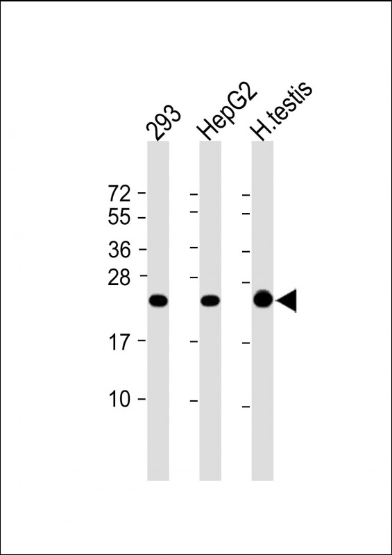 AK1 / Adenylate Kinase 1 Antibody - All lanes: Anti-AK1 Antibody (C-term) at 1:4000 dilution Lane 1: 293 whole cell lysate Lane 2: HepG2 whole cell lysate Lane 3: Human testis lysate Lysates/proteins at 20 µg per lane. Secondary Goat Anti-mouse IgG, (H+L), Peroxidase conjugated at 1/10000 dilution. Predicted band size: 22 kDa Blocking/Dilution buffer: 5% NFDM/TBST.