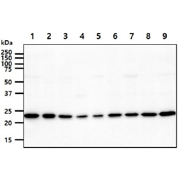 AK1 / Adenylate Kinase 1 Antibody - The cell lysates (40ug) were resolved by SDS-PAGE, transferred to PVDF membrane and probed with anti-human AK1 antibody (1:1000). Proteins were visualized using a goat anti-mouse secondary antibody conjugated to HRP and an ECL detection system. Lane 1.: HeLa cell lysate Lane 2.: U87-MG cell lysate Lane 3.: K562 cell lysate Lane 4.: 293T cell lysate Lane 5.: HepG2 cell lysate Lane 6.: A549 cell lysate Lane 7.: MCF7cell lysate Lane 8.: SK-OV-3 cell lysate Lane 9.: PC3 cell lysate