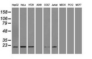 AK1 / Adenylate Kinase 1 Antibody - Western blot of extracts (35 ug) from 9 different cell lines by using anti-AK1 monoclonal antibody.
