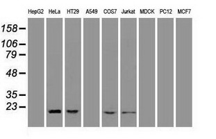 AK1 / Adenylate Kinase 1 Antibody - Western blot analysis of extracts (35ug) from 9 different cell lines by using anti-AK1 monoclonal antibody.