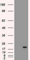 AK1 / Adenylate Kinase 1 Antibody - HEK293T cells were transfected with the pCMV6-ENTRY control (Left lane) or pCMV6-ENTRY AK1 (Right lane) cDNA for 48 hrs and lysed. Equivalent amounts of cell lysates (5 ug per lane) were separated by SDS-PAGE and immunoblotted with anti-AK1.