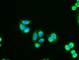 AK1 / Adenylate Kinase 1 Antibody - Immunofluorescent staining of HT29 cells using anti-AK1 mouse monoclonal antibody.