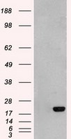 AK1 / Adenylate Kinase 1 Antibody - HEK293T cells were transfected with the pCMV6-ENTRY control (Left lane) or pCMV6-ENTRY AK1 (Right lane) cDNA for 48 hrs and lysed. Equivalent amounts of cell lysates (5 ug per lane) were separated by SDS-PAGE and immunoblotted with anti-AK1.