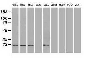 AK1 / Adenylate Kinase 1 Antibody - Western blot of extracts (35 ug) from 9 different cell lines by using anti-AK1 monoclonal antibody.