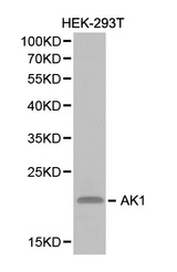 AK1 / Adenylate Kinase 1 Antibody - Western blot of AK1 pAb in extracts from HEK-293T cells.