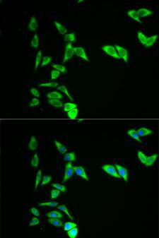 AK1 / Adenylate Kinase 1 Antibody - Immunofluorescence analysis of A549 cells.