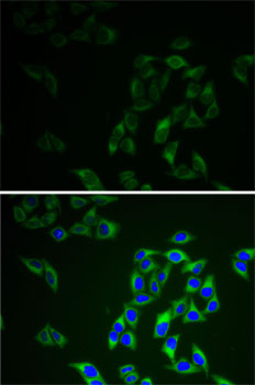 AK1 / Adenylate Kinase 1 Antibody - Immunofluorescence analysis of HeLa cells using AK1 antibody. Blue: DAPI for nuclear staining.